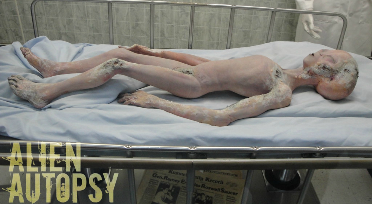 Thumbnail for Ep. #383: Alien Autopsy w/ Philip Mantle